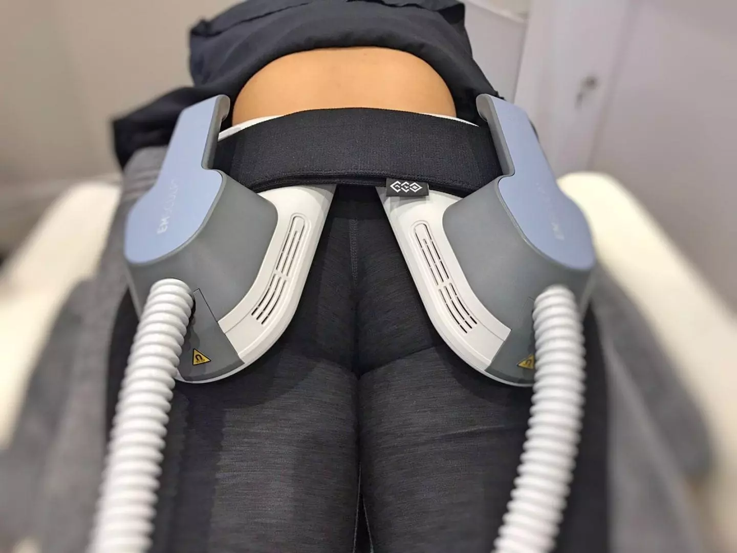 EMSculpt at S-Thetics Clinic in Beaconsfield