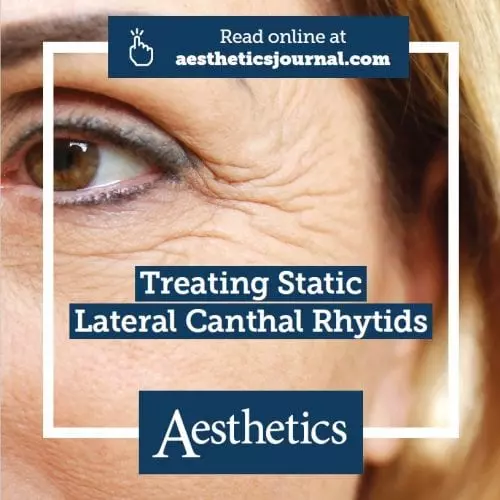 Aesthetics Journal Expert Opinion – Treating Static Lateral Canthal Rhytids (‘Crow’s Feet’)
