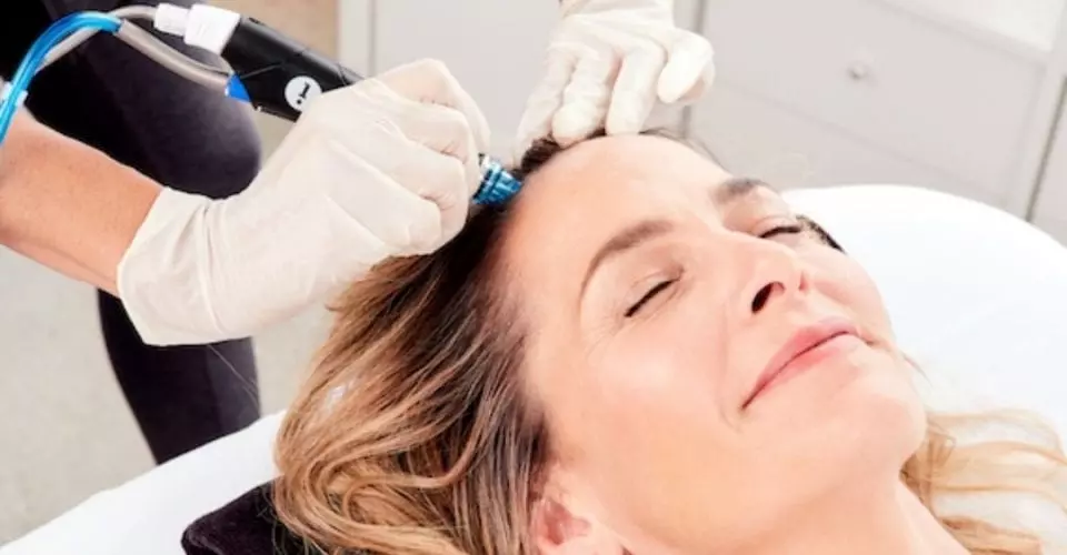 Introducing HydraFacial Keravive for Scalp Health