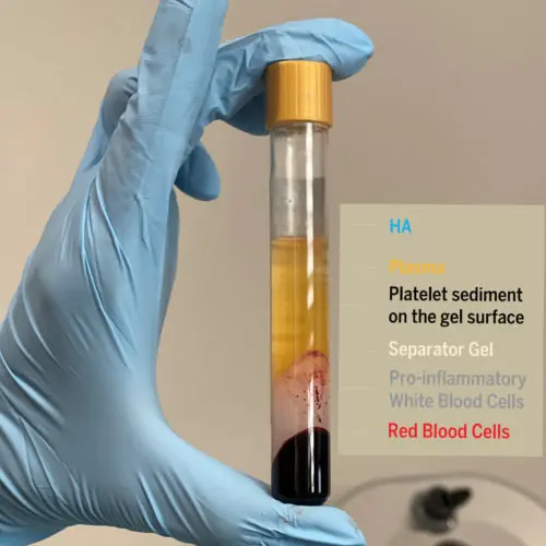 Introducing the ‘Golden Glow Facial ‘Treatment at S-Thetics Clinic