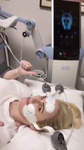 EMFACE-at-S-Thetics-Clinic-Rebel-Wilson-shares-her-EMFACE-experience-and-results