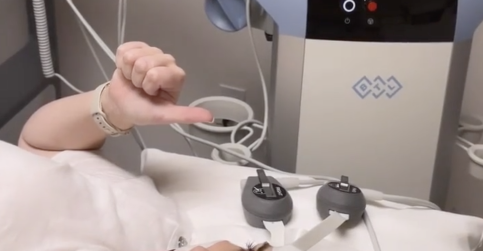 Hollywood Actress, Writer & Producer Rebel Wilson shares her EMFACE treatment experience