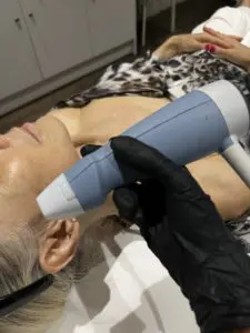 BTL-Exion-Clear-RF-launches-at-S-Thetics-Clinic-in-Beaconsfield-clear-skin6IMG_9955 2