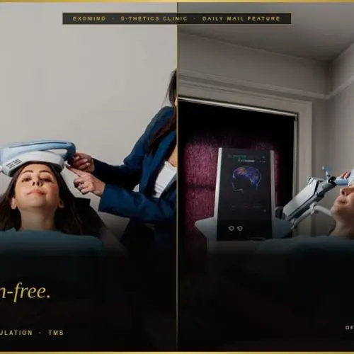 S-Thetics Clinic’s Exomind Treatment Featured in the Daily Mail