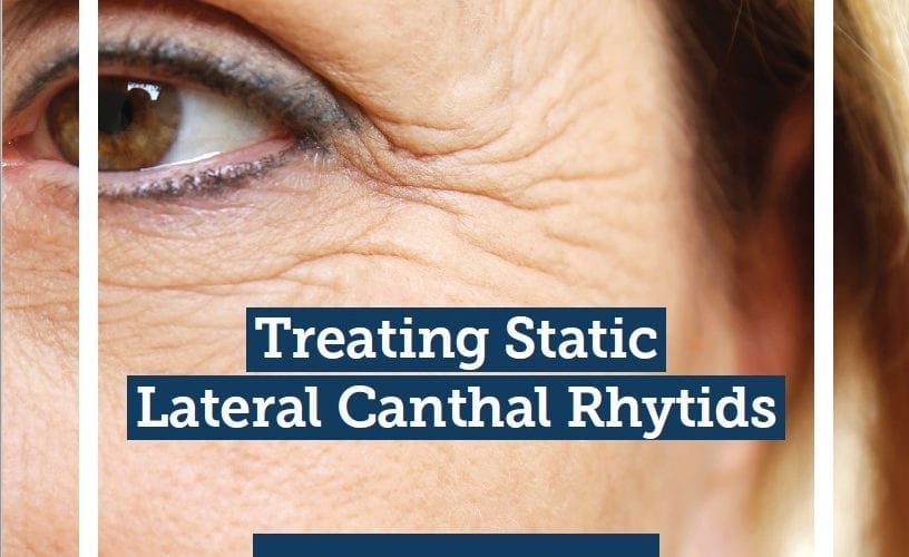 Aesthetics Journal Expert Opinion – Treating Static Lateral Canthal Rhytids (‘Crow’s Feet’)
