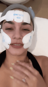 Vanessa-Hudgens-shares-her-EMFACE-treatment-experience-available-at-S-Thetics-Clinic-beaconsfield