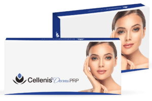 introducing-cellenis-dermafiller-at-S-Thetics-Clinic-regenerative-facial-filler-miss-sherina-balaratnam5