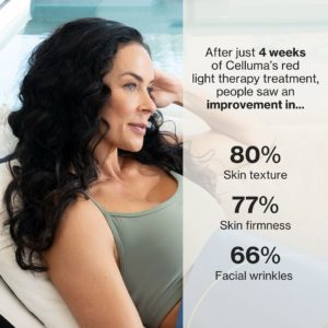 Celluma Light Therapy Available at S-Thetics Clinic in Beaconsfield11